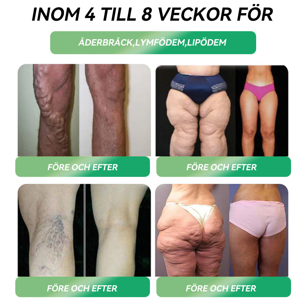 STDEI® 💧GLP-1 Viktminskning Oral Lösning Endast en gång i veckan, första förändringar synliga på 7 dagar ✅