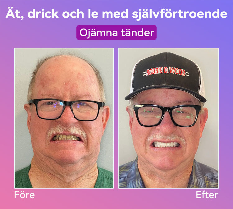 𝐉𝐚𝐬𝐬𝐞𝐞𝐦® Senaste Premium Komfort Tandproteser🎁 (Högkvalitativa Tandproteser, Bekväma att Bära - Begränsad Tid 70% Rabatt)