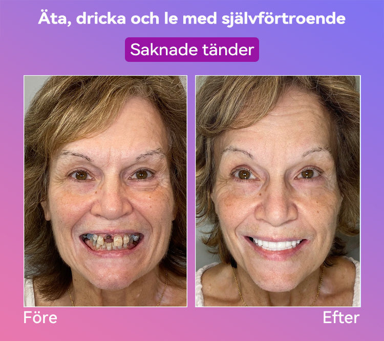 𝐉𝐚𝐬𝐬𝐞𝐞𝐦® Senaste Premium Komfort Tandproteser🎁 (Högkvalitativa Tandproteser, Bekväma att Bära - Begränsad Tid 70% Rabatt)