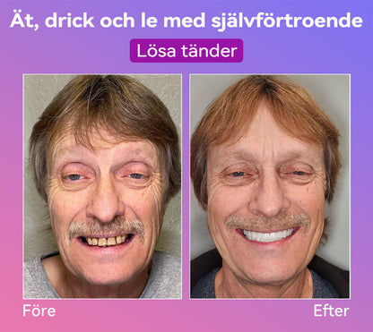 𝐉𝐚𝐬𝐬𝐞𝐞𝐦® Senaste Premium Komfort Tandproteser🎁 (Högkvalitativa Tandproteser, Bekväma att Bära - Begränsad Tid 70% Rabatt)
