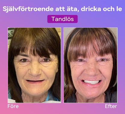 𝐉𝐚𝐬𝐬𝐞𝐞𝐦®🍀 Senaste Premium Komfort Tandproteser (Högkvalitativa Tandproteser, Bekväma att Bära - Begränsad Tid 70% Rabatt)🔥