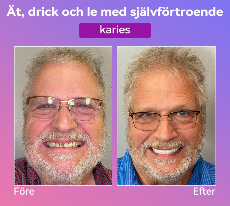 𝐉𝐚𝐬𝐬𝐞𝐞𝐦®🍀 Senaste Premium Komfort Tandproteser (Högkvalitativa Tandproteser, Bekväma att Bära - Begränsad Tid 70% Rabatt)🔥