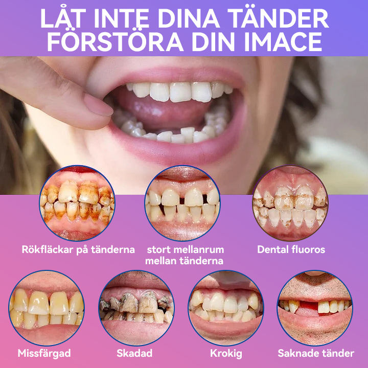 𝐉𝐚𝐬𝐬𝐞𝐞𝐦®🍀 Senaste Premium Komfort Tandproteser (Högkvalitativa Tandproteser, Bekväma att Bära - Begränsad Tid 70% Rabatt)🔥