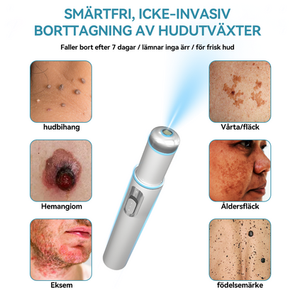 𝐁𝐢𝐤𝐞𝐧𝐝𝐚® medicinsk laserpenna 💕 (använder koldioxidlaserteknologi – effektiv för att ta bort födelsemärken, vårtor, hudflikar, pigmentfläckar och andra hudfel)🏆