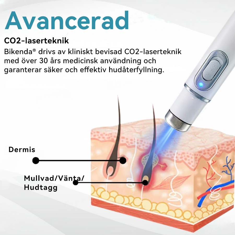 Bikenda® laserpenna🎁 (med CO₂-laserteknik – effektiv för att ta bort födelsemärken, vårtor, hudflikar, pigmentfläckar och andra hudproblem)