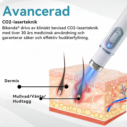 Bikenda® laserpenna🎁 (med CO₂-laserteknik – effektiv för att ta bort födelsemärken, vårtor, hudflikar, pigmentfläckar och andra hudproblem)